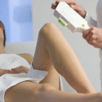 Uşak’ta Buz Lazer Nedir?